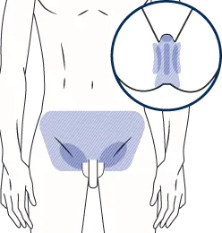VI