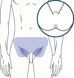 VO
