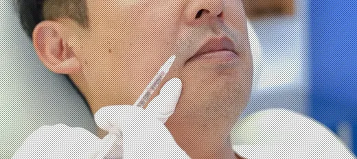 注入治療