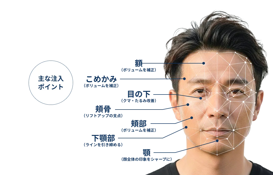 主な注入ポイント