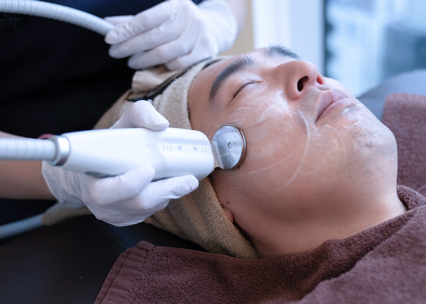 エレクトロポレーション