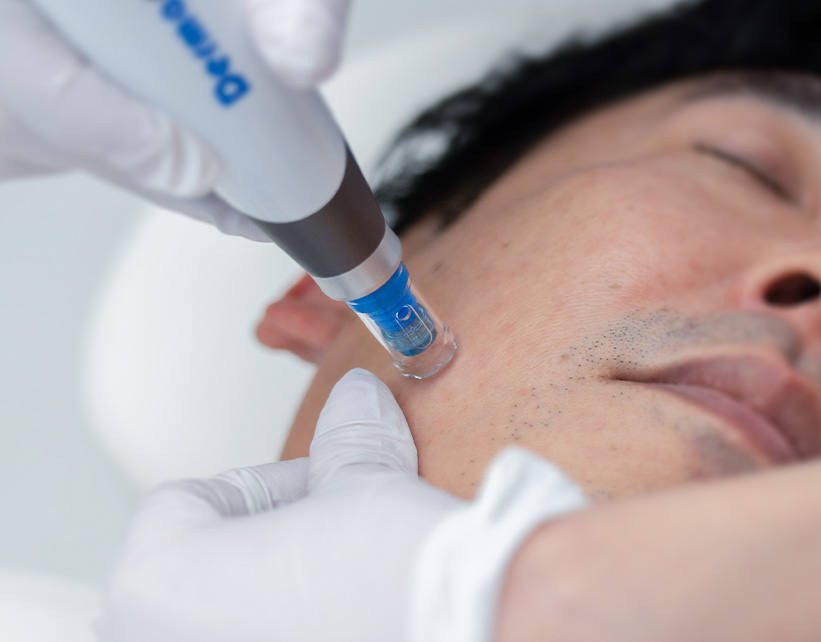 PRP療法の期待できる効果