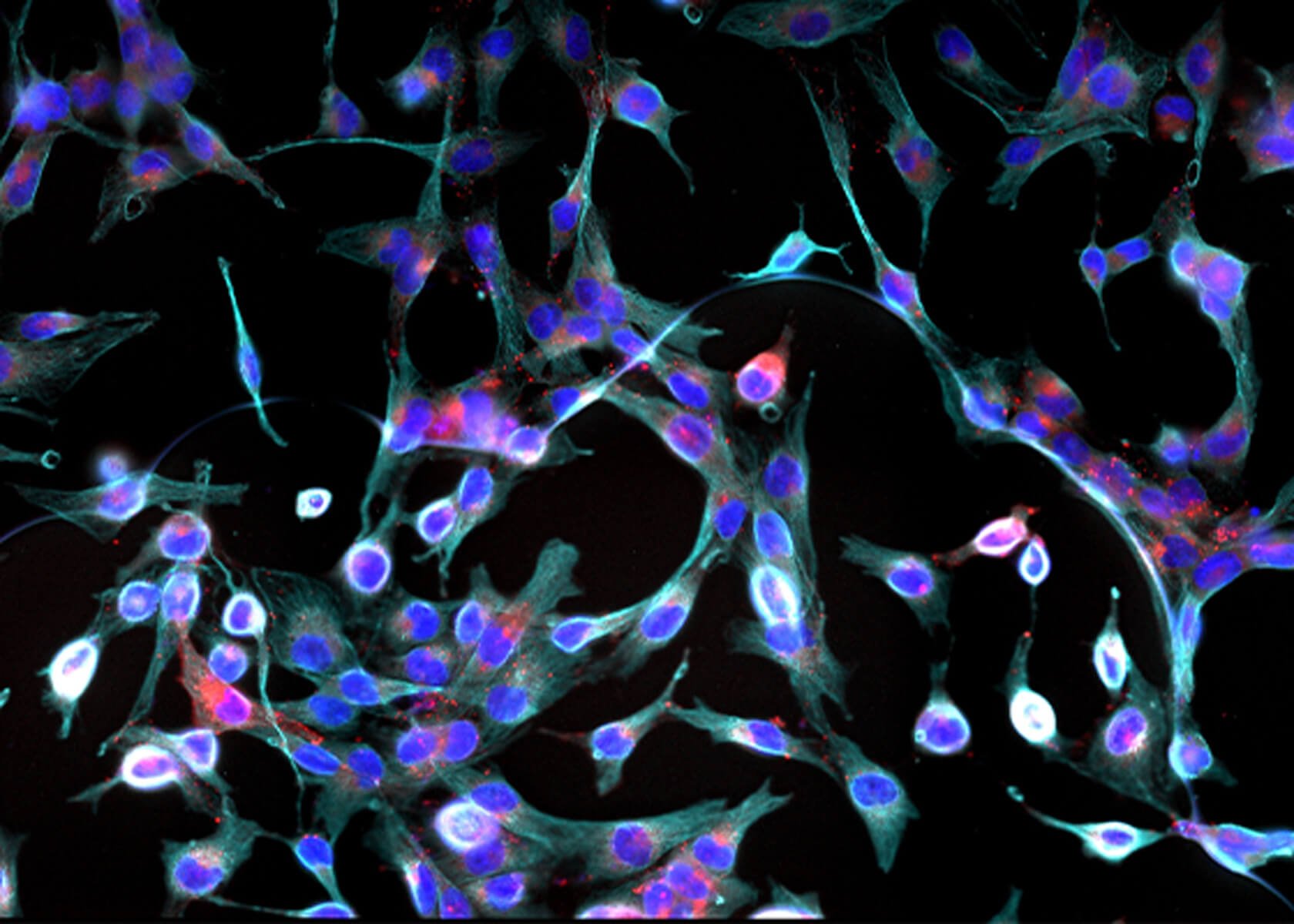 線維芽細胞移植治療とは