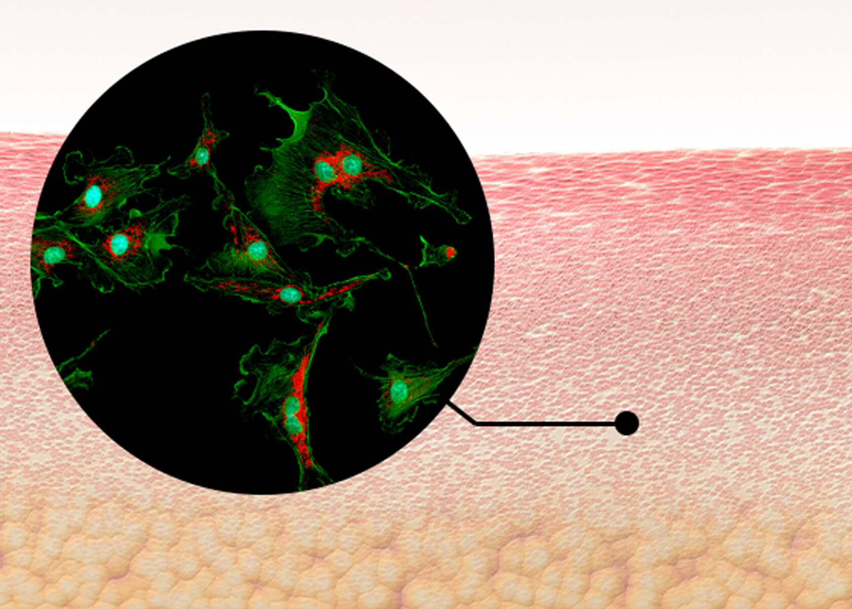 What's 線維芽細胞