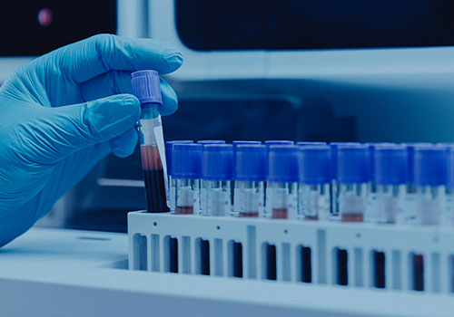 ヴァンパイアフェイシャル