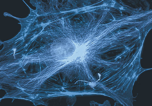 線維芽細胞移植