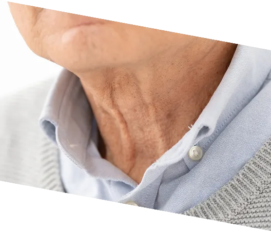 あご・フェイスライン