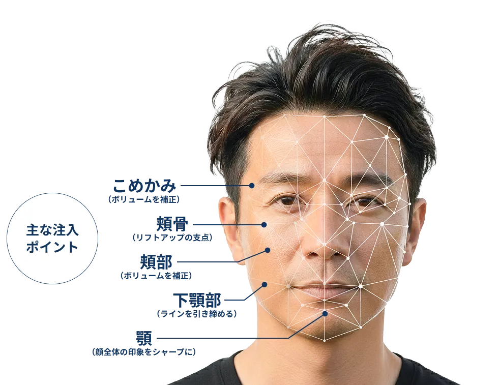 主な注入ポイント