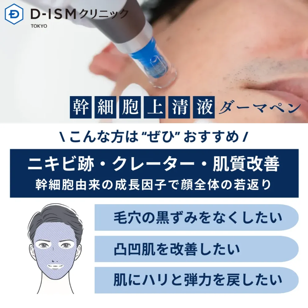お顔全体の若返り　男の肌を根本改善　幹細胞上清液ダーマペン